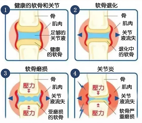 關節變化過程