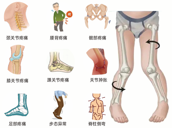 錯誤下肢力線的危害