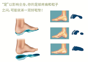 直樂矯形鞋墊